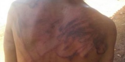 Cacoal - Menor é acusado de furto no Paineiras e população dá uma surra no adolescente
