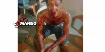 Apenado com tornozeleira é baleado na noite deste sábado, em Ji-Paraná