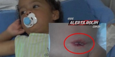 Rolim de Moura – Família necessita urgente de ajuda para tratamento de criança com graves problemas renais – hidronefrose bilateral