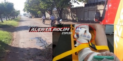 Rolim de Moura - Galho de árvore cai sobre mulher enquanto trafegava de moto e um graveto fica cravado em sua perna