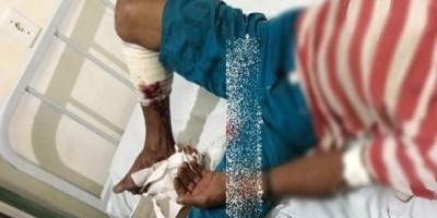 Caçador é atingido por disparo acidental de arma, em Espigão do Oeste