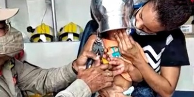 Menino de 2 anos fica com panela presa na cabeça, em RO