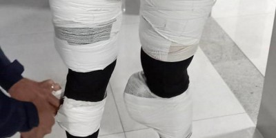 PRF prende mulher com cocaína presa ao corpo em RO