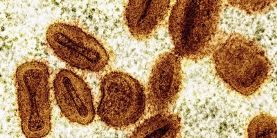 Quatro casos de mpox são confirmados em Rondônia