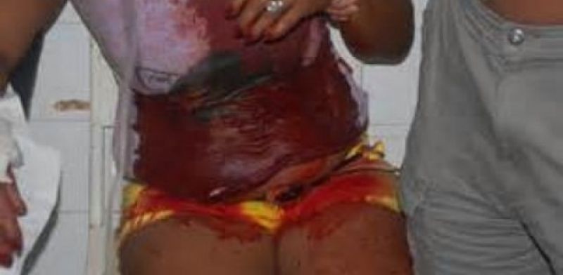 Buritis: Mulher esfaqueia “amiga” flagrada comendo farinha com açúcar junto com o seu marido Buritis: Mulher esfaqueia “amiga” flagrada comendo farinha com açúcar junto com o seu marido