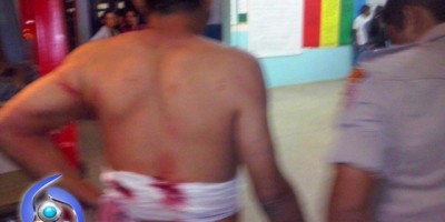 Ji-Paraná – Homem leva cinco facadas de desconhecido enquanto bebia em bar Ji-Paraná – Homem leva cinco facadas de desconhecido enquanto bebia em bar
