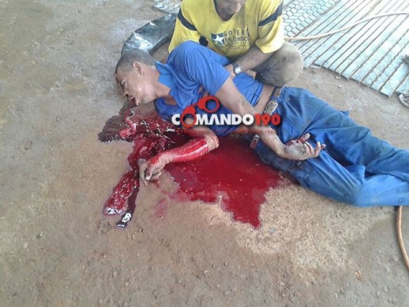 Ji-Paraná - ACIDENTE DE TRABALHO – Pneu de trator estoura e borracheiro fica entre a vida e a morte Ji-Paraná - ACIDENTE DE TRABALHO – Pneu de trator estoura e borracheiro fica entre a vida e a morte