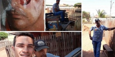Rolim de Moura - Filho conta história do pai que perdeu um olho vítima de câncer e pede ajuda à internet e tv Rolim de Moura - Filho conta história do pai que perdeu um olho vítima de câncer e pede ajuda à internet e tv
