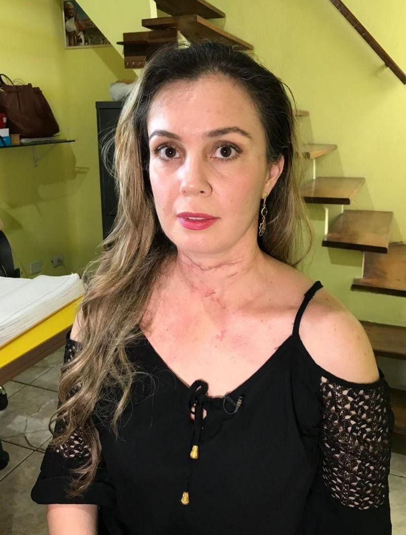 Brasil - Agredida com mais de 70 facadas faz alerta a mulheres em relações abusivas: ‘não existe ex-agressor’ Brasil - Agredida com mais de 70 facadas faz alerta a mulheres em relações abusivas: ‘não existe ex-agressor’