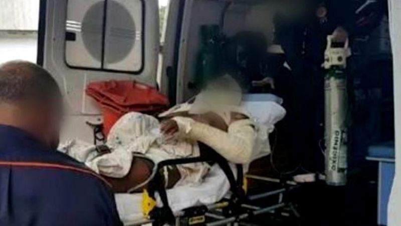 Mulher tem o corpo queimado pelo marido ao atender ligação de outro homem, em Chupinguaia Mulher tem o corpo queimado pelo marido ao atender ligação de outro homem, em Chupinguaia