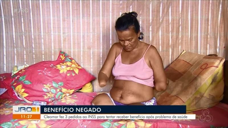 Mulher sem mãos e pernas tem pedido de benefício negado pelo INSS por não poder assinar papel, em RO Mulher sem mãos e pernas tem pedido de benefício negado pelo INSS por não poder assinar papel, em RO