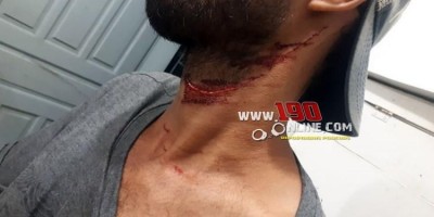 Alta Floresta –  Por dívida de R$10,00, homem termina  ferido por golpe de canivete no pescoço  Alta Floresta –  Por dívida de R$10,00, homem termina  ferido por golpe de canivete no pescoço