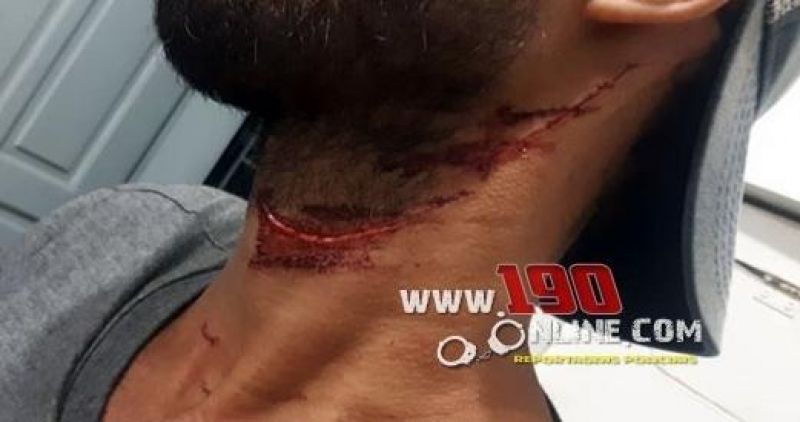 Alta Floresta – Por dívida de R$10,00, homem termina ferido por golpe de canivete no pescoço Alta Floresta – Por dívida de R$10,00, homem termina ferido por golpe de canivete no pescoço