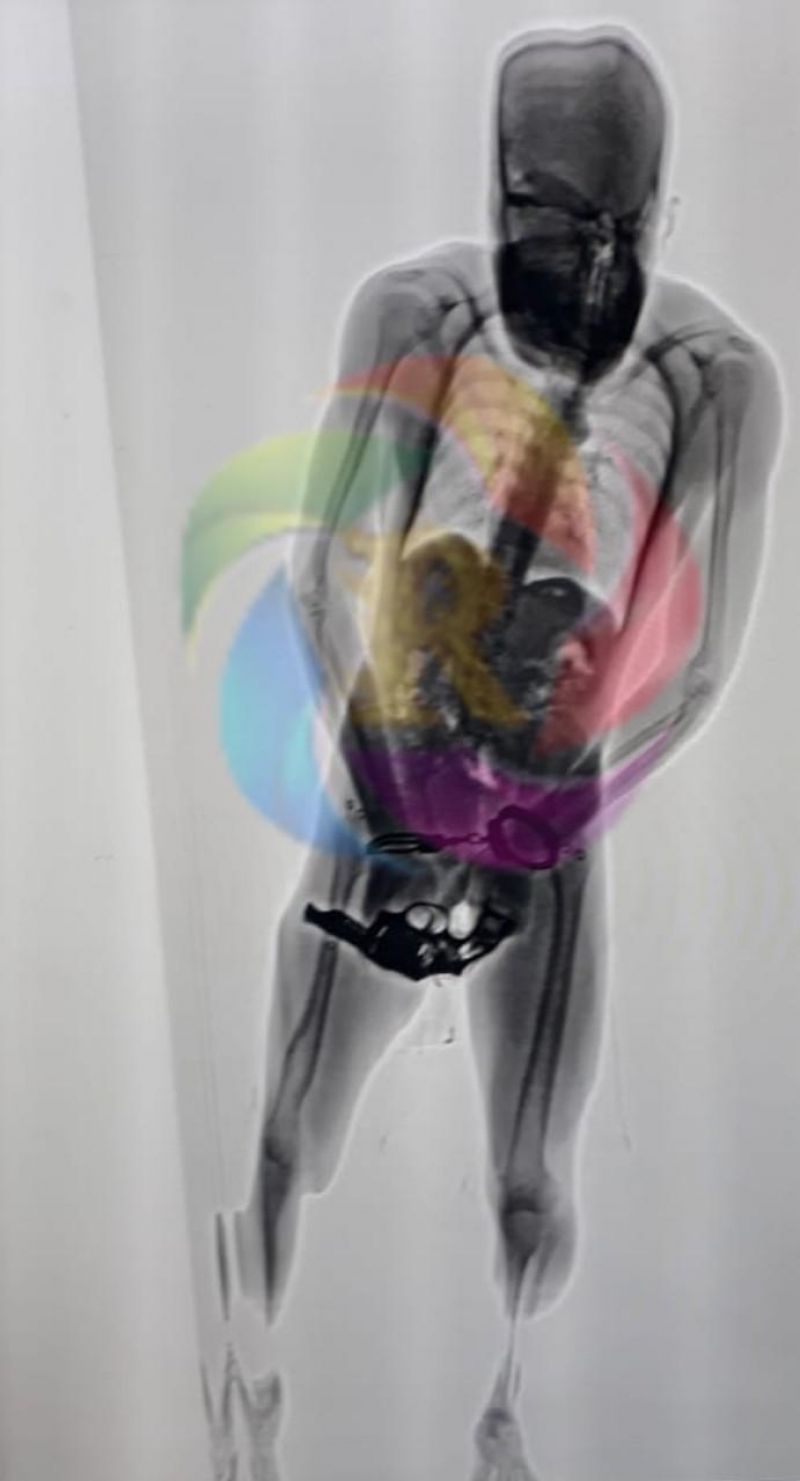 Preso dá entrada no Presídio Urso Branco com arma de fogo dentro de bermuda, em Porto Velho Preso dá entrada no Presídio Urso Branco com arma de fogo dentro de bermuda, em Porto Velho