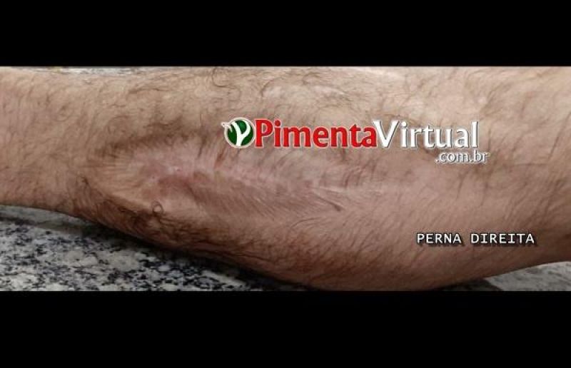 Funerária divulga imagens do corpo encontrado em rio para possível identificação, em Pimenta Bueno Funerária divulga imagens do corpo encontrado em rio para possível identificação, em Pimenta Bueno