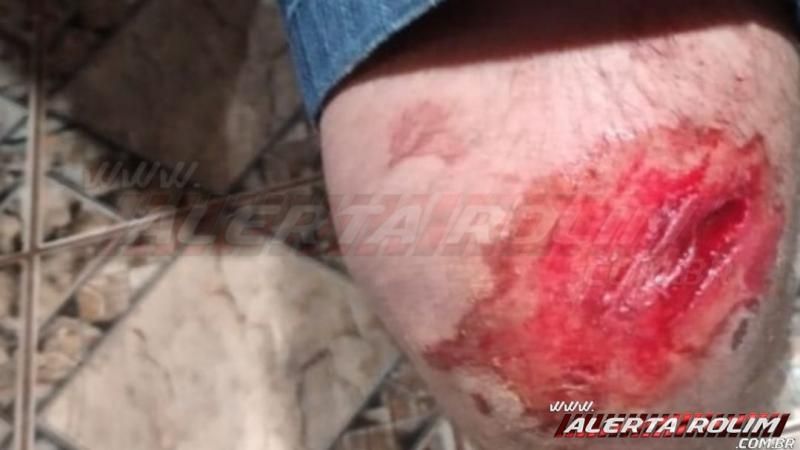 Rolim de Moura - Quarto acidente é registrado na noite de sexta-feira - Vídeo Rolim de Moura - Quarto acidente é registrado na noite de sexta-feira - Vídeo