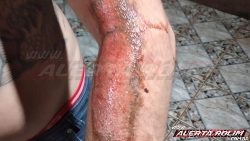 Rolim de Moura - Quarto acidente é registrado na noite de sexta-feira - Vídeo Rolim de Moura - Quarto acidente é registrado na noite de sexta-feira - Vídeo