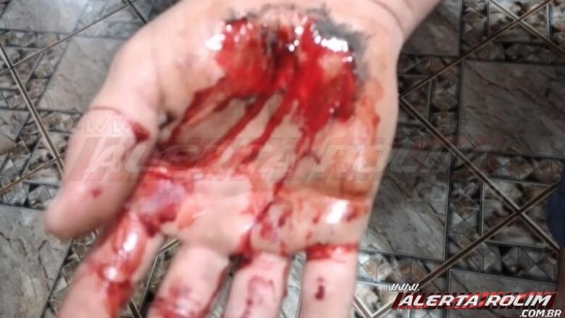 Rolim de Moura - Quarto acidente é registrado na noite de sexta-feira - Vídeo Rolim de Moura - Quarto acidente é registrado na noite de sexta-feira - Vídeo