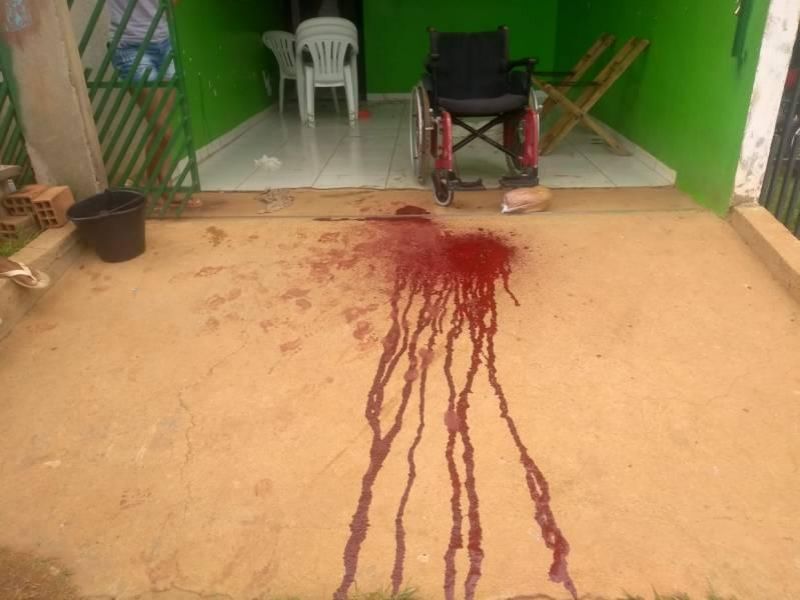 Cadeirante é baleado na cabeça, em Vilhena Cadeirante é baleado na cabeça, em Vilhena