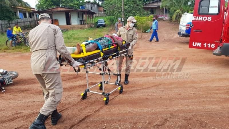 Condutor perde dois dedos do pé após colisão entre duas motos no Bairro Jardim Tropical em Rolim de Moura Condutor perde dois dedos do pé após colisão entre duas motos no Bairro Jardim Tropical em Rolim de Moura