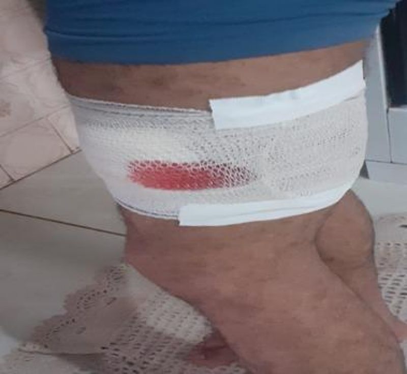 SANEROM pede ajuda da população para que coletores de lixo não sejam atacados por cães SANEROM pede ajuda da população para que coletores de lixo não sejam atacados por cães