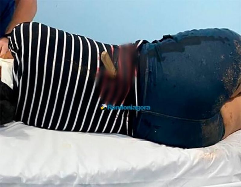 Homem crava faca nas costas de ex-mulher em RO Homem crava faca nas costas de ex-mulher em RO