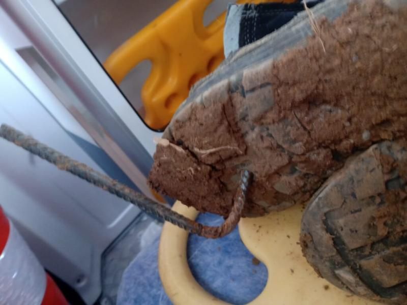 Em Vilhena trabalhador sofre queda e barra de ferro perfura seu pé Em Vilhena trabalhador sofre queda e barra de ferro perfura seu pé