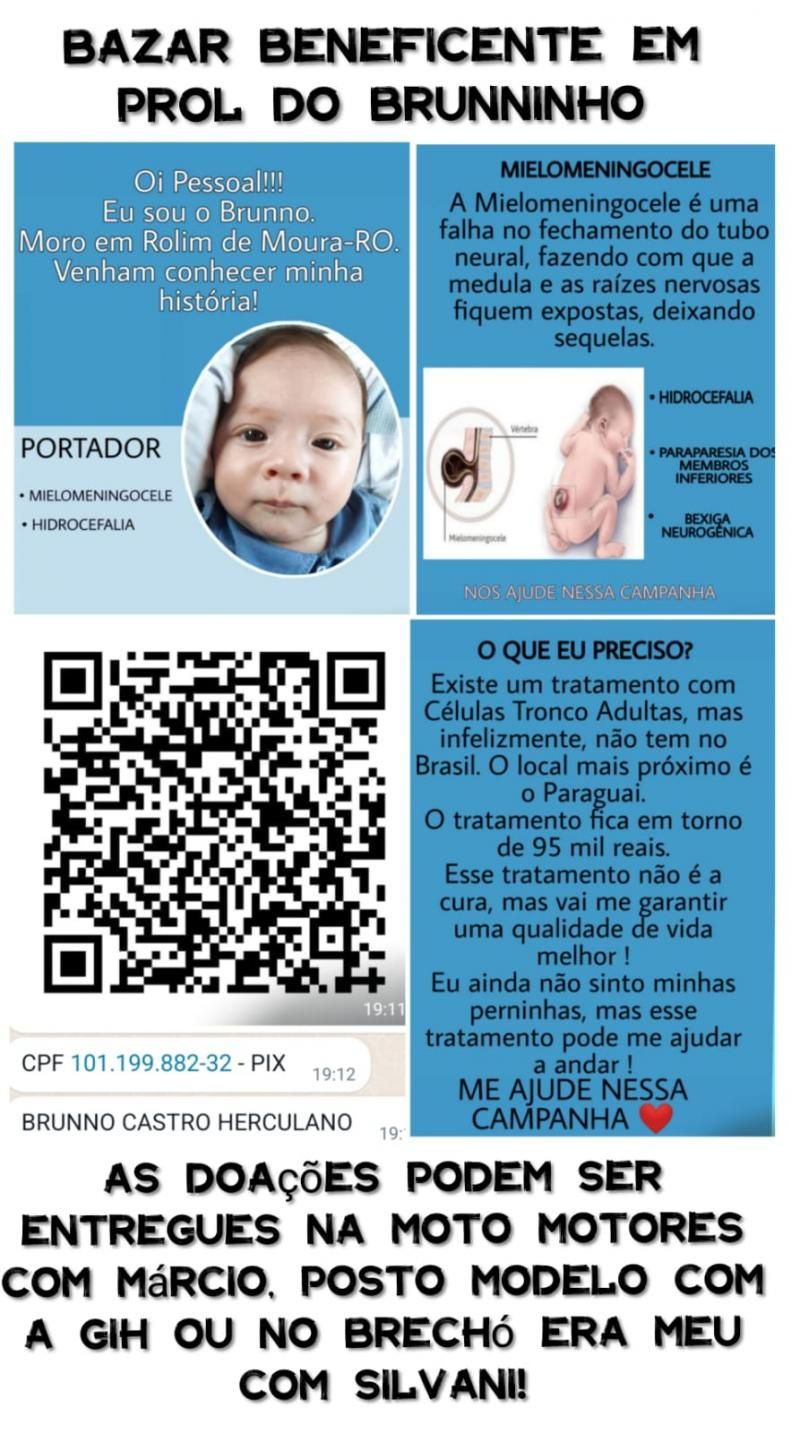 Criança, moradora de Rolim de Moura, de apenas 07 meses, precisa de ajuda de quase 100 mil reais em cirurgia, que não existe no Brasil Criança, moradora de Rolim de Moura, de apenas 07 meses, precisa de ajuda de quase 100 mil reais em cirurgia, que não existe no Brasil