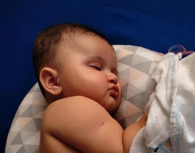 Bebê de 01 ano de Rolim de Moura precisa de ajuda para tratamento de plagiocefalia; entenda o caso e veja como ajudar Bebê de 01 ano de Rolim de Moura precisa de ajuda para tratamento de plagiocefalia; entenda o caso e veja como ajudar