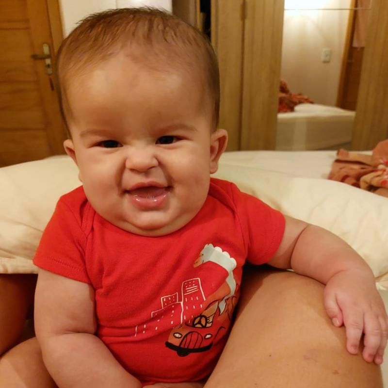 Vaquinha online é realizada para arrecadar fundos para o tratamento de braquicefalia, de criança de apenas 05 meses de idade Vaquinha online é realizada para arrecadar fundos para o tratamento de braquicefalia, de criança de apenas 05 meses de idade